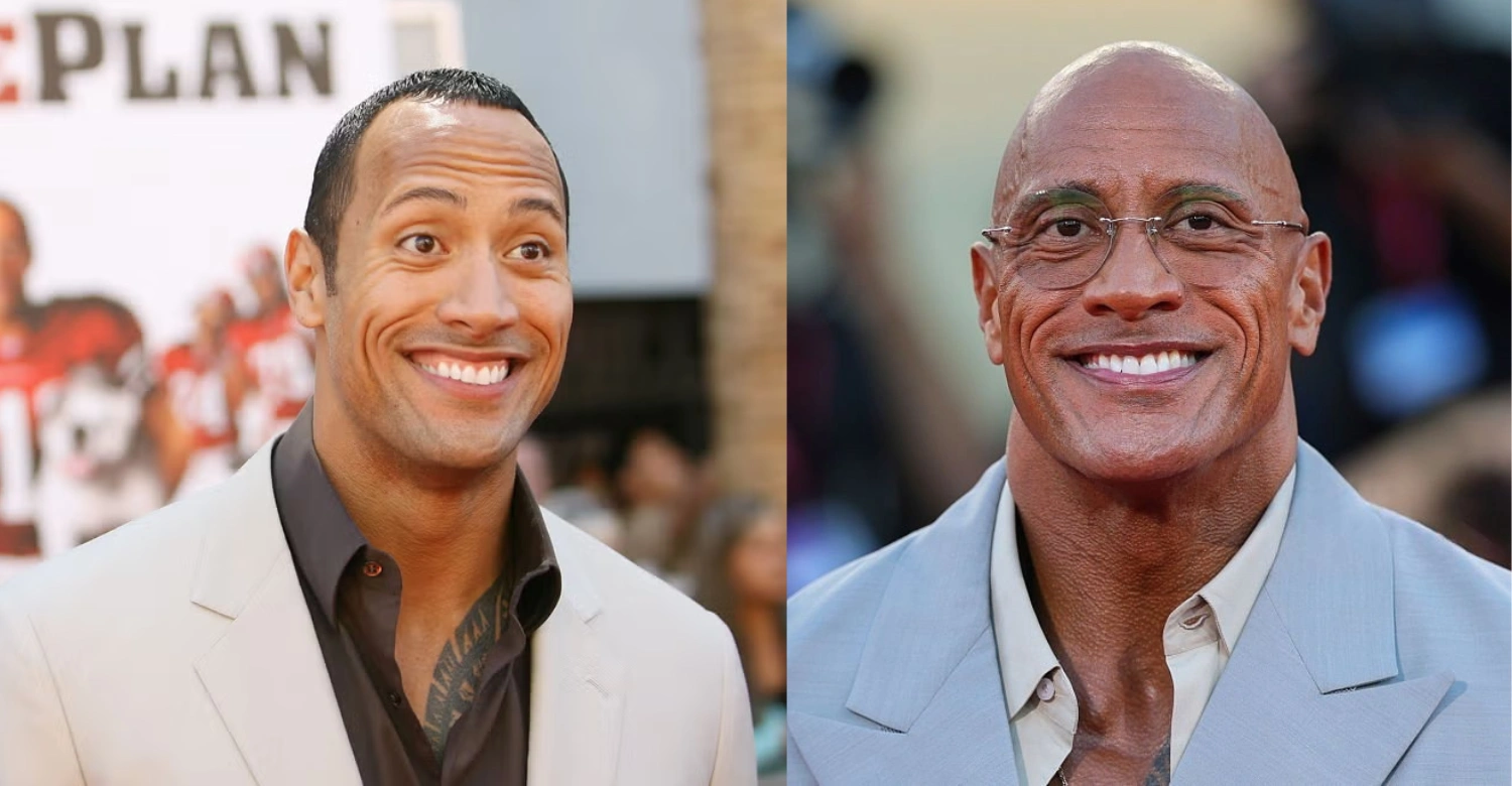 Dwayne Johnson teeth 2